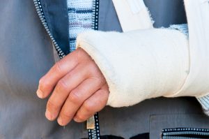 Macomb Law Group, personal injury attorneys image of a Man's arm in cast and sling